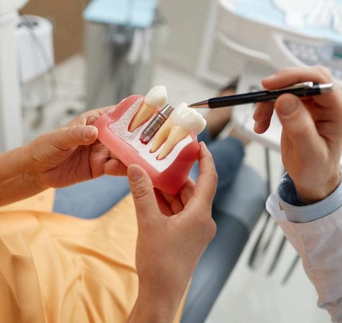 dental implants - Kirkland Dentist dental implants - Kirkland Dentist